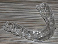 Brushing Your Braces