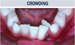 Crowding