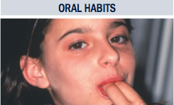 Oral Habits